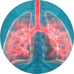 valves-endobronchiques Oxygénothérapie